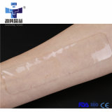High Quality Scar Removal Silicone Sheet for Scar and Injury Healing