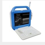 Ultrasound Scanner with Convex Linear Trans-Vaginal Trans-Rectal Probe for Option