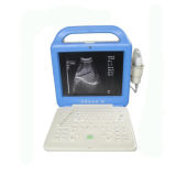 Hot Sale Cheap Portable Ultrasound Scanner with 2 Probe Connectors